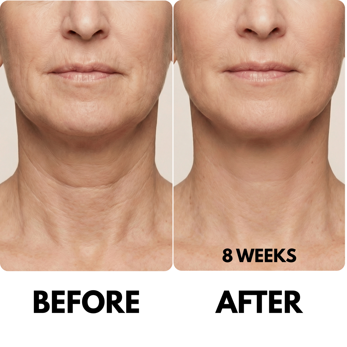Advanced Neck Lift Cream